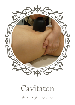 キャビテーション