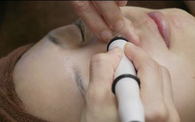 ハイドロピール