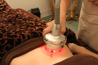 脂肪吸引ラジオ波